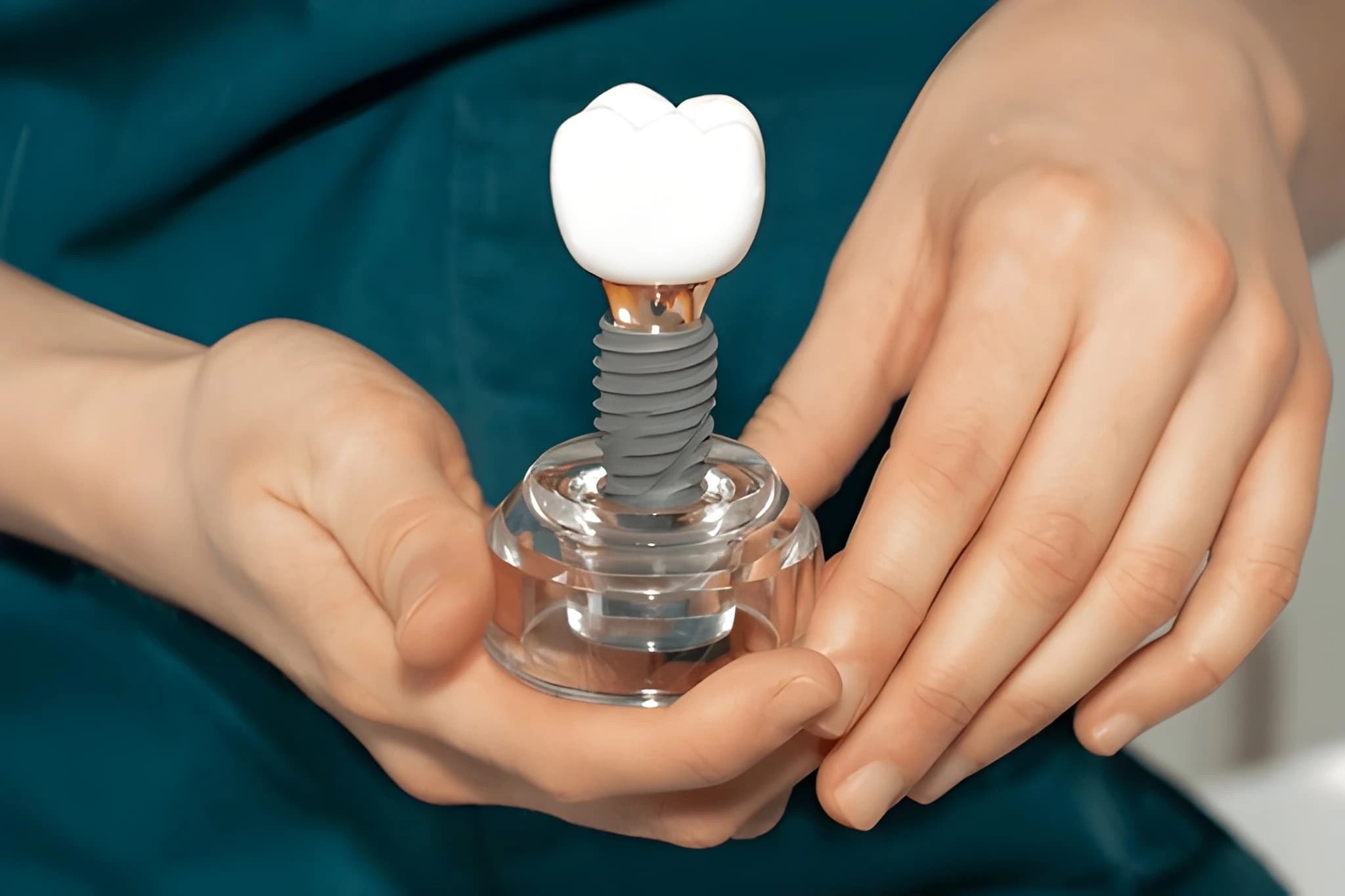 dental implants in edmonton