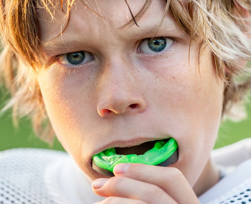 dental guards and appliances in edmonton