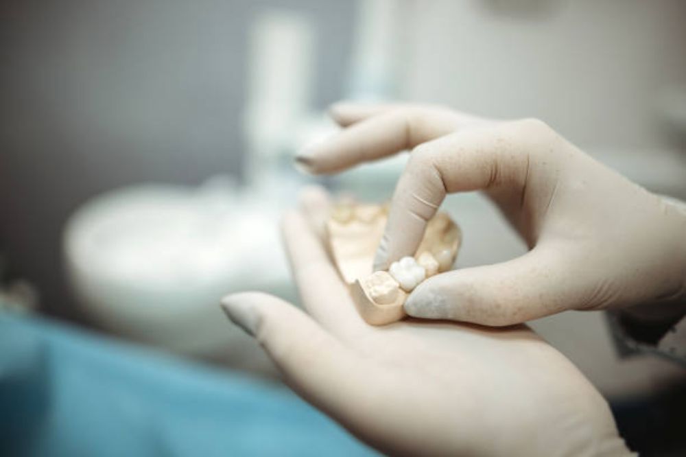 dental crowns the ultimate solution for damaged or weakened teeth