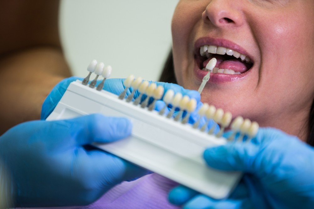 can porcelain veneers transform a worn or stained smile